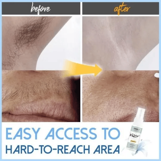 Hot Sale 49% Off - Semi-permanent Hair Removal Spray - BUY 1 GET 1 FREE