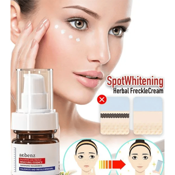 Vitamin C Whitening Freckles Face Cream Remove Melasma Dark Spots Lighten Melanin Acne Scar Anti-aging Brighten